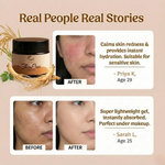 Skin Ease Moisturizer